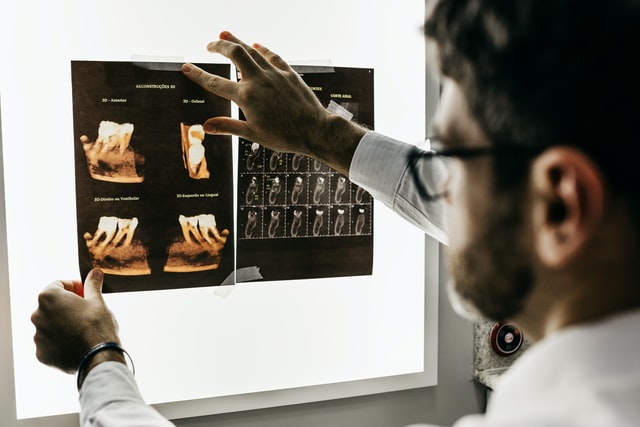 dentist looking at x rays of someone's teeth