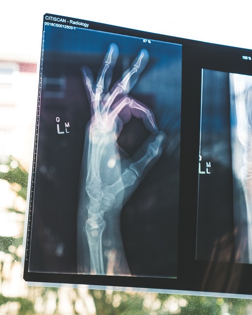 x ray of a hand giving the OK signal